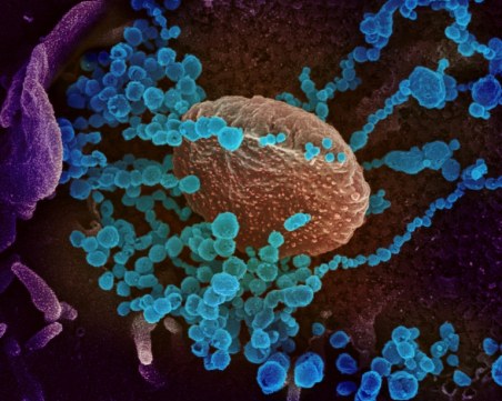 COVID може да се е адаприрал към човешкото тяло още през 2012 г.