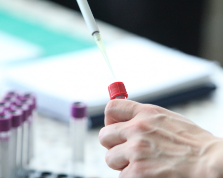 14 нови случая на Covid-19 в Пловдив! Повече излекувани, отколкото заразени за 24 часа