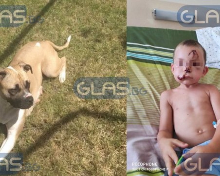 Куче нахапа зверски дете от Пловдив