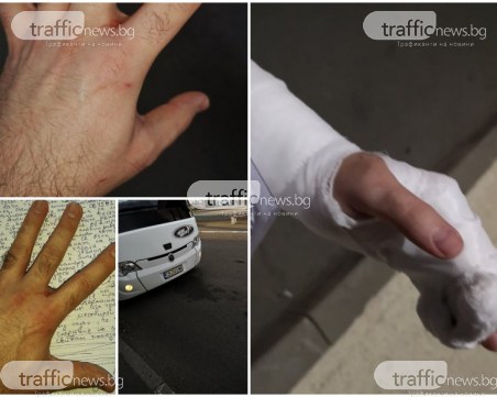 Шофьор на автобус рита пловдивчанин, ръката му - в гипс заради една снимка