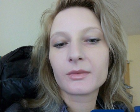 Прокуратурата проверява стопанката на кучето, обезобразило дете от Пловдив