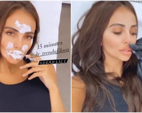 Николета пак се боцна, направи си устни и запълни бръчките