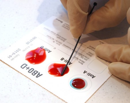 При коя кръвна група рискът от зараза с COVID-19 е най-нисък?