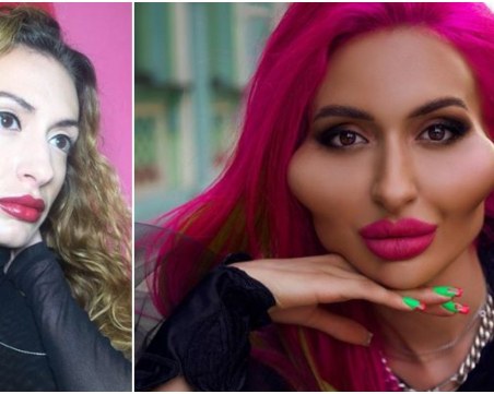 Жената, обсебена от скулите си: Сега мъжете ме обичат повече