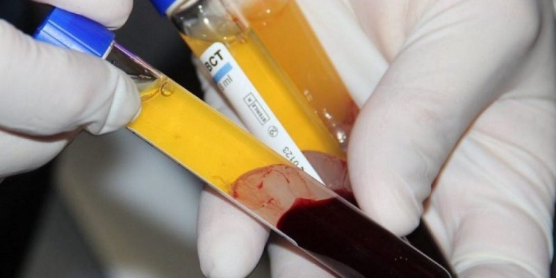 Спешно търсят плазма от кръвни групи АБ и А за трима пациенти с коронавирус