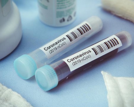 Лекар от Ямбол се зарази повторно с коронавирус