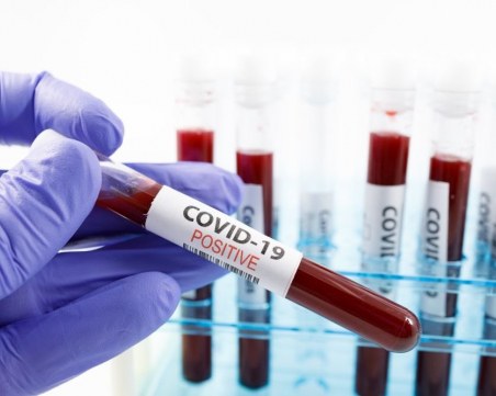 Вирусолог посочи фактор, влияещ върху повторната инфекция с COVID-19