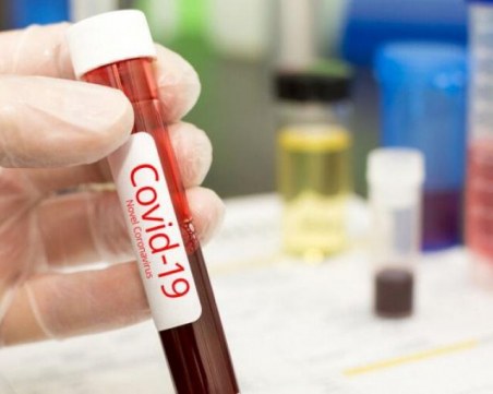 Каракачанов разпореди: Преболедувалите военни да дарят кръвна плазма