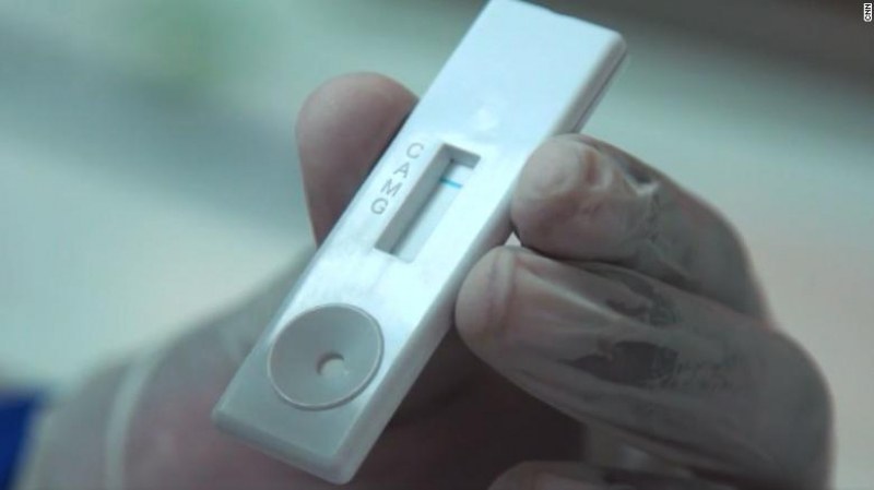 В Африка подготвят тест, който показва за минути дали имаш COVID-19