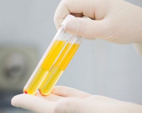 Магистрати, преболедували COVID, даряват кръвна плазма