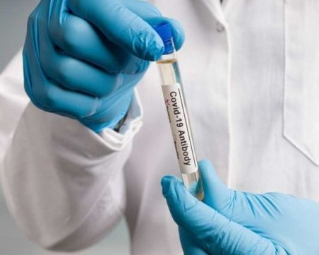 Ново изследванe: Мъжете по-бързо губят антитела срещу коронавируса