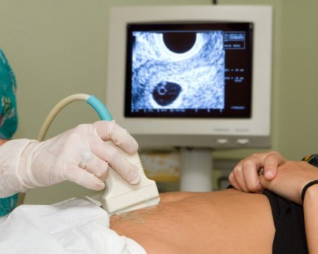 На всяко четвърто раждане в Пловдивско – по един аборт