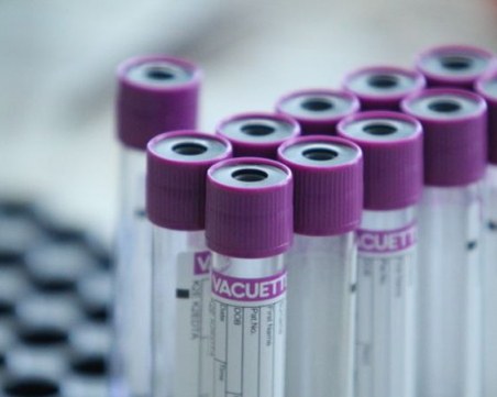 Учени с интересно откритие за имунитета на безсимптомни носители на COVID-19