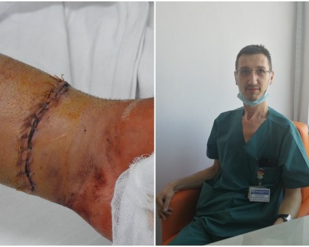 В болница в Пловдив спасиха от ампутация срязана с ъглошлайф ръка