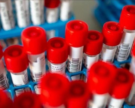 Почти 8000 нови случая на COVID-19 са регистрирани в Сърбия