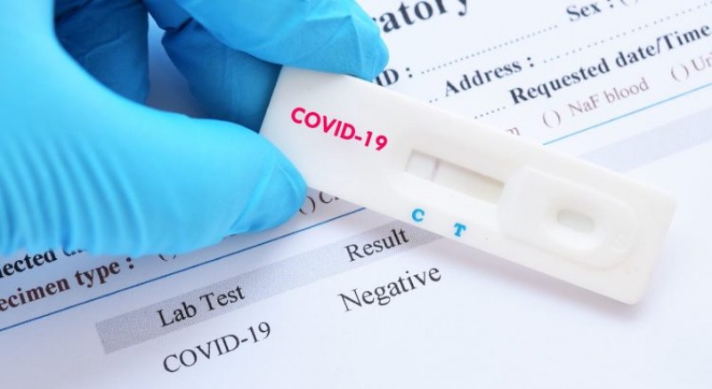 Турски лекар изобрети тест за COVID-19 с урина
