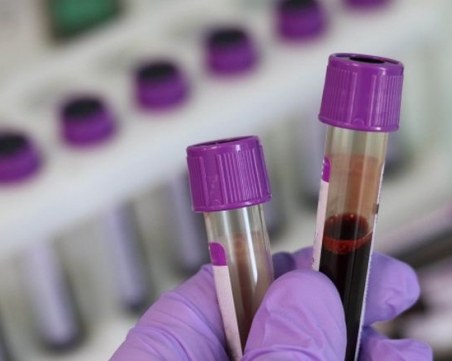 Пациент се разболя от ку-треска през януари