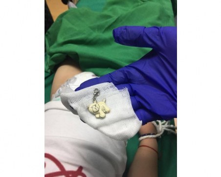 Изкараха ключодържател от хранопровода на 2-годишно дете