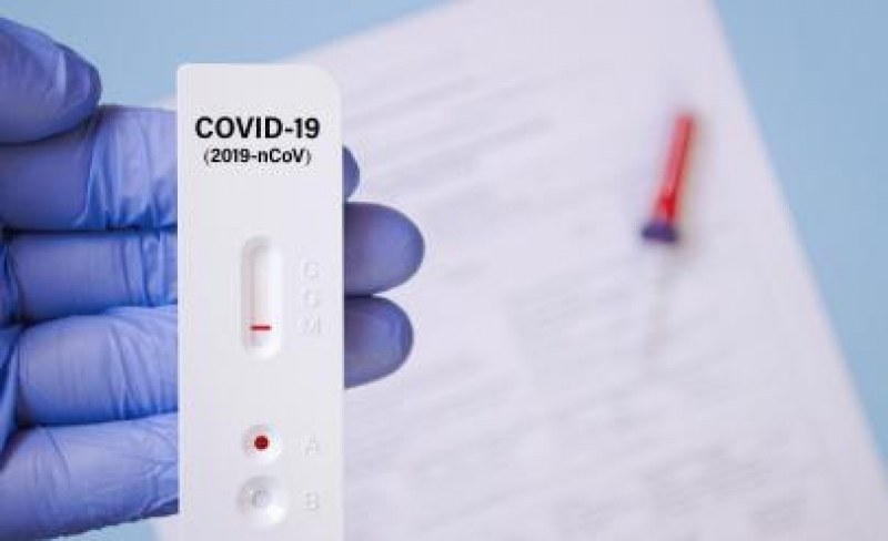За седмица ще бъдат тествани за COVID-19 всички учители в Пловдивско