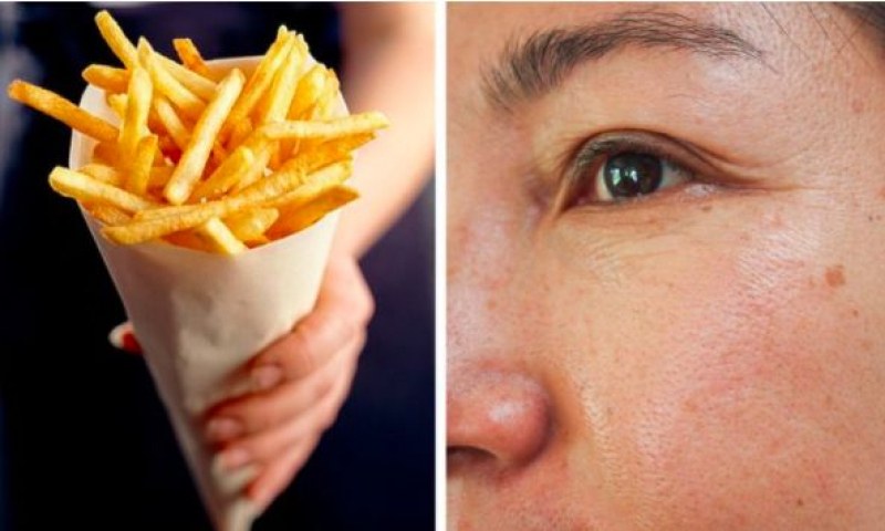 11 храни, които трябва да избягвате, ако искате гладка кожа без бръчки