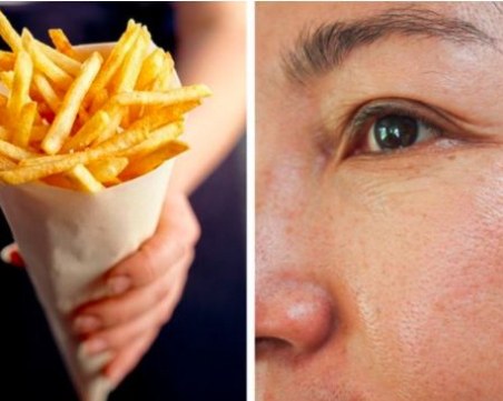 11 храни, които трябва да избягвате, ако искате гладка кожа без бръчки