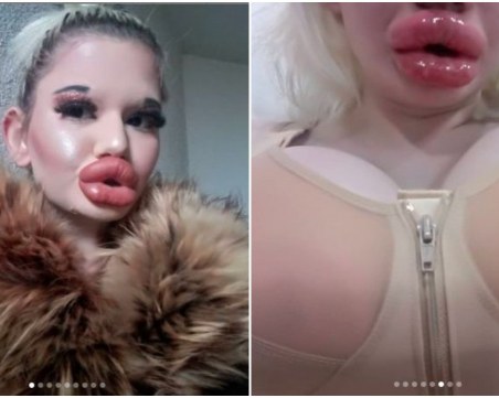 БГ Барби си сложи 1200 кубика силикон и се закани: Мисля да ги направя двойни