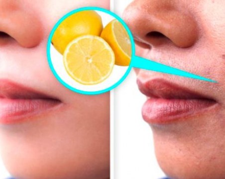 7 неща, които могат да причинят тъмни петна по лицето ви