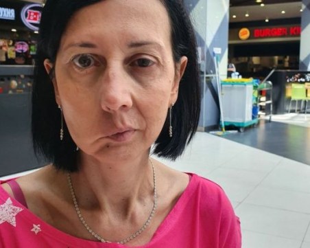 Росица от Карлово не може да движи дясната половина на лицето си, нуждае се от операция