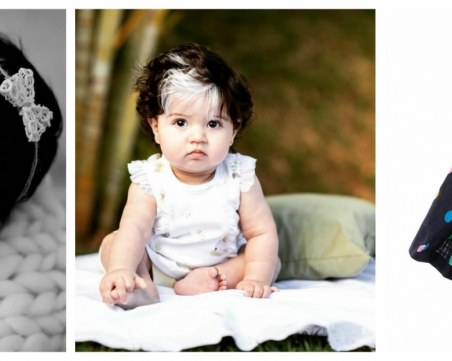 Детето, което живее от две години с голям бял кичур в косата, получен при раждането