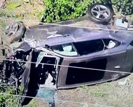 Тайгър Уудс с няколко операции след катастрофата