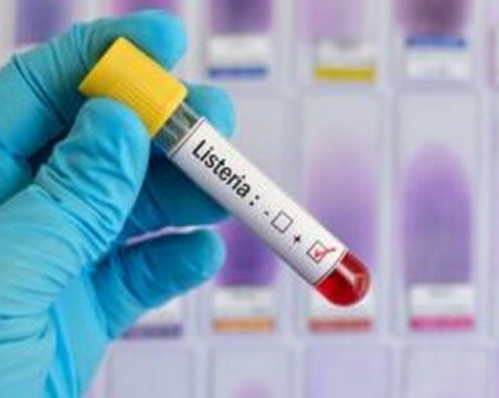 Откриха случай на листериоза у нас