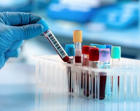 7 кръвни теста, които трябва да правите веднъж годишно