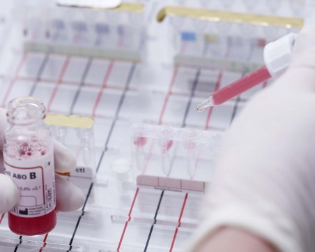 САЩ ще изследва Moderna и Pfizer заради сигнал за алергичен шок