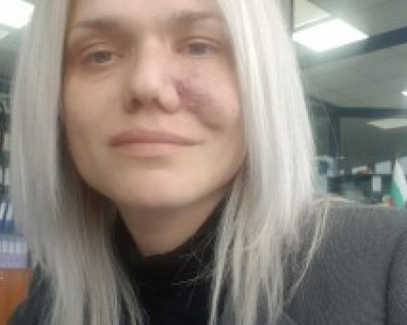 След години лутане по болници: 34-годишна жена се нуждае от 65 000 евро, за да живее