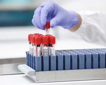 В Пловдив стартира нов тест за клетъчен имунитет