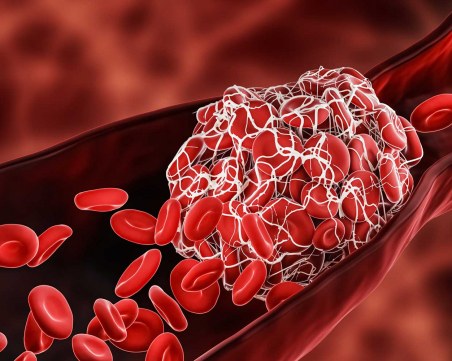 Германски учени: Знаем как да спрем тромбозите при векторните ваксини