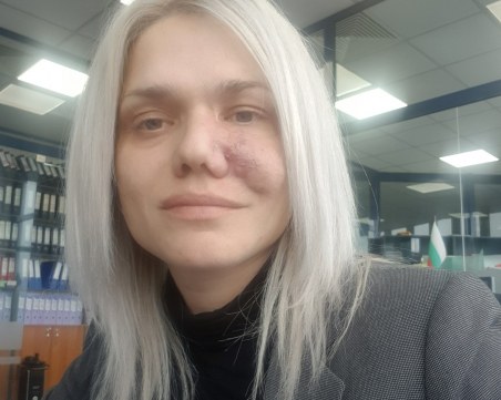 Жена от Пловдив се нуждае от помощ