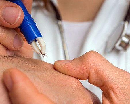 Откриха първи случай на опасно заболяване, пренасяно от кърлежи