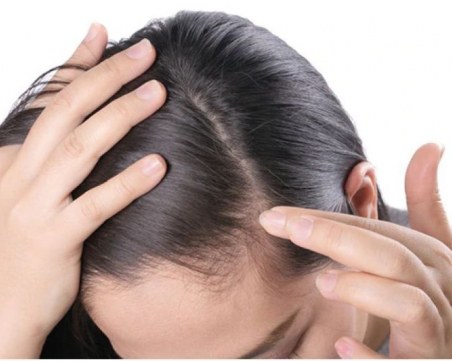 Наистина ли стресът води до побеляване на косата