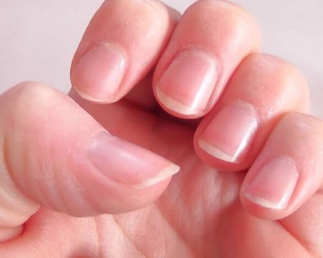 Скритите послания: Видът на ноктите показва състоянието на черния дроб