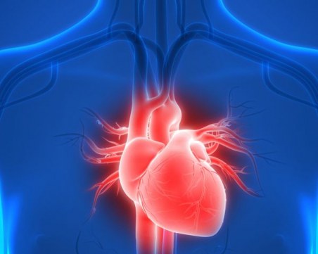 Първата трансплантация на изцяло изкуствено сърце беше извършена в Европа