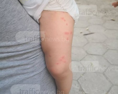 Напаст! Пловдив пламна от бълхи