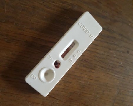 МЗ официално: Ето какво трябва да знаем за антителата срещу COVID-19