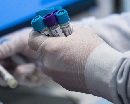 Прекаралите COVID-19 са изложени на по-голям риск в жегите