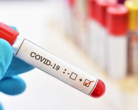 Преболедувалите COVID-19 имат антитела поне година след това