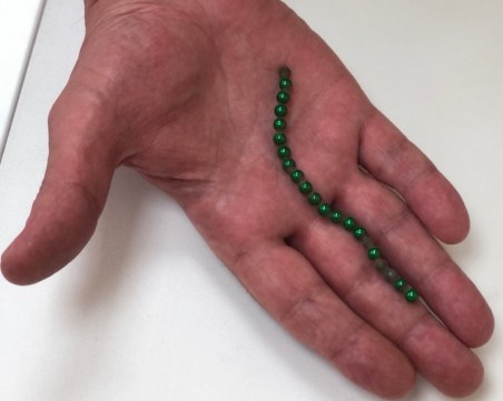 След предизвикателство в TikTok: Дете се бори за живота си, погълнало магнитни топчета