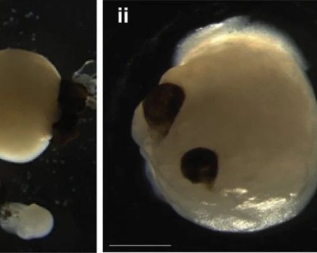 Учени отгледаха човешки мини мозъци с очи