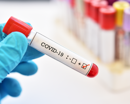 Епидемичен взрив от COVID-19 в шивашки цех в Бургас