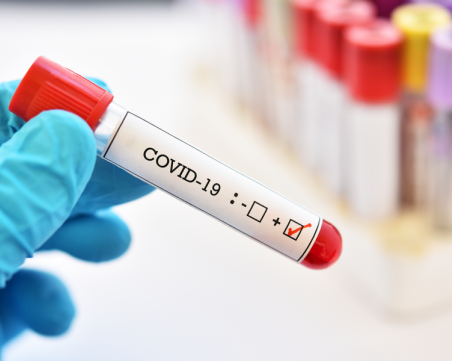 Епидемичен взрив от COVID-19 в кабелен завод в Бургас