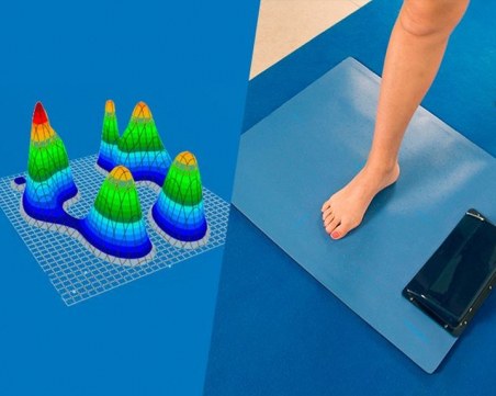 Безплатни консултации за пациенти с плоскостъпие стартират в Пловдив